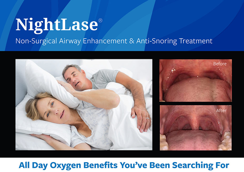 Fotona Nightlase - Laser airway enhancement for snoring treatment