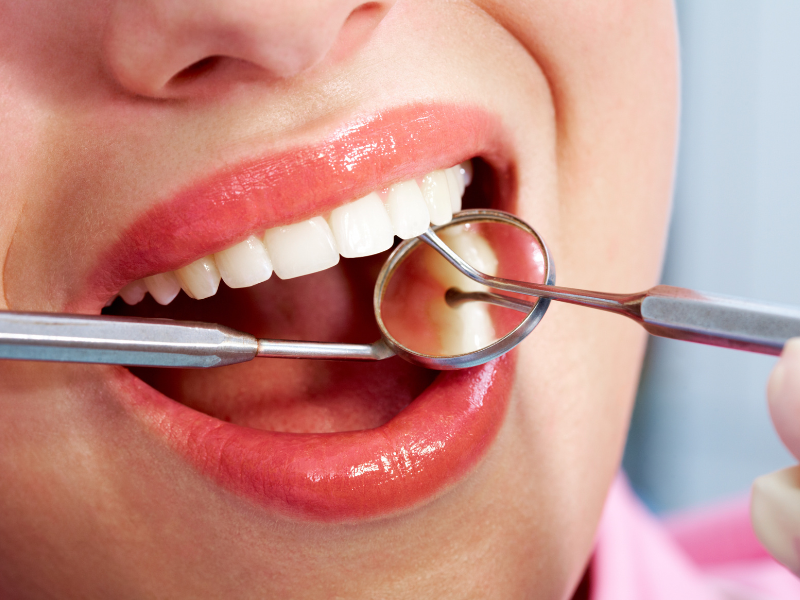 Dental bonding and tooth repairs in Jacksonville, FL